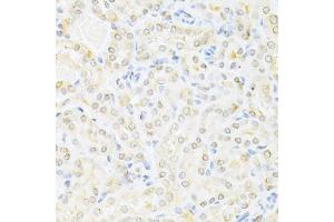 Immunohistochemistry of paraffin-embedded mouse kidney using SUMO1 Antibody (ABIN5971157) at dilution of 1/200 (40x lens). (SUMO1 Antikörper)