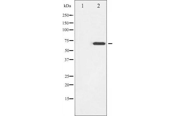 ZAP70 anticorps  (pTyr319)