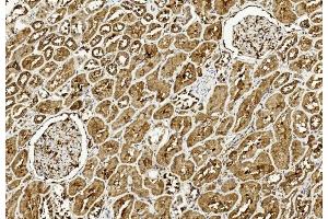 Immunohistochemical analysis of paraffin-embedded Human kidney section using Pink1 am8437c. (ULK3 Antikörper  (C-Term))