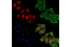 Phospho-MCM2 (Ser108) Antibody staining Hela cells(heat shock treatment) by IF/ICC. (MCM2 Antikörper  (pSer108))