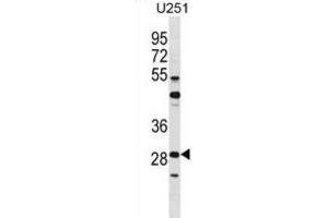 Western Blotting (WB) image for anti-FOS-Like Antigen 2 (FOSL2) antibody (ABIN2998778) (FOSL2 Antikörper)