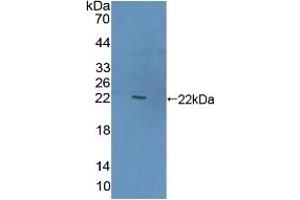 Detection of Recombinant CLEC10A, Human using Polyclonal Antibody to Cluster Of differentiation 301 (CD301) (CLEC10A Antikörper  (AA 71-239))