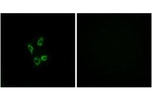 Immunofluorescence analysis of HuvEc cells, using Cytochrome P450 4Z1 Antibody. (CYP4Z1 Antikörper  (AA 71-120))