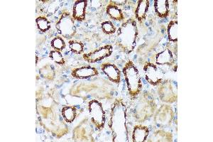 Immunohistochemistry of paraffin-embedded rat kidney using W/W/W Rabbit mAb (ABIN7271346) at dilution of 1:100 (40x lens). (WASF2 Antikörper)