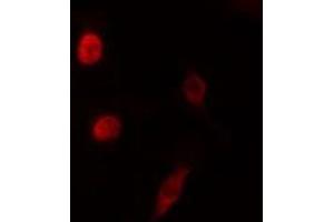 ABIN6276550 staining HeLa cells by IF/ICC. (NEUROD1 Antikörper  (N-Term))