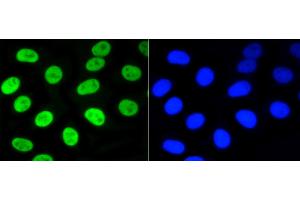 HepG2 cells were stained with Nrf2(S40) (7G4) Monoclonal Antibody  at [1:200] incubated overnight at 4C, followed by secondary antibody incubation, DAPI staining of the nuclei and detection. (NRF2 Antikörper  (pSer40))
