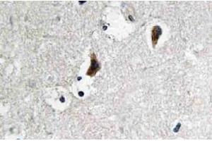 Immunohistochemistry (IHC) analyzes of c-Src antibody in paraffin-embedded human brain tissue. (NCOA1 Antikörper)