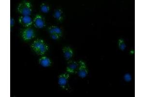 Immunofluorescence (IF) image for anti-Hydroxyacid Oxidase (Glycolate Oxidase) 1 (HAO1) antibody (ABIN1498576) (HAO1 Antikörper)