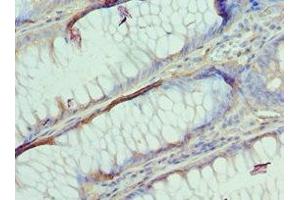 Immunohistochemistry (IHC) image for anti-Adaptor-Related Protein Complex 2, beta 1 Subunit (AP2B1) (AA 738-937) antibody (ABIN7144363)