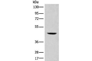 Western blot analysis of 293T cell lysate using SHPK Polyclonal Antibody at dilution of 1:500 (SHPK Antikörper)