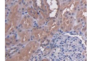 DAB staining on IHC-P; Samples: Human Kidney Tissue (N-Acetyl alpha-D-Glucosaminidase (AA 485-743) Antikörper)