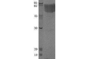 THSD1 Protein (Transcript Variant 1) (His tag)