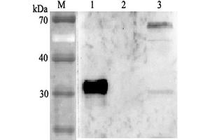 Western blot analysis using anti-ANGPTL4 (human), pAb  at 1:2'000 dilution. (ANGPTL4 Antikörper)