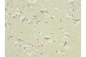 Immunohistochemistry of paraffin-embedded human brain tissue using ABIN7173719 at dilution of 1:100 (TTLL7 Antikörper  (AA 1-260))