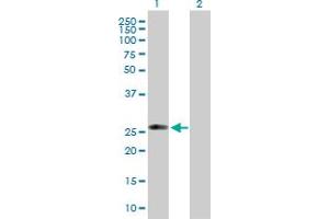 Western Blot analysis of C1QTNF5 expression in transfected 293T cell line by C1QTNF5 MaxPab polyclonal antibody. (CTRP5 Antikörper  (AA 1-243))