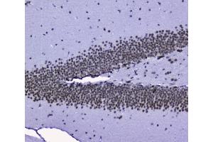 IHC analysis of nmt55/p54nrb using anti-nmt55/p54nrb antibody (ABIN3044530). (NONO Antikörper  (N-Term))