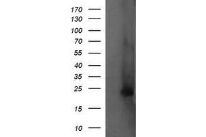 Image no. 2 for anti-Fetal and Adult Testis Expressed 1 (FATE1) antibody (ABIN1498223) (FATE1 Antikörper)