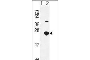 Western blot analysis of EPGN (arrow) using rabbit polyclonal EPGN Antibody (N-term) (ABIN655189 and ABIN2844805). (Epigen Antikörper  (N-Term))
