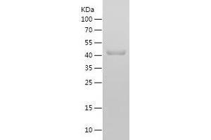 Western Blotting (WB) image for Insulin-Like Growth Factor 1 Receptor (IGF1R) (AA 741-935) protein (His-IF2DI Tag) (ABIN7123451) (IGF1R Protein (AA 741-935) (His-IF2DI Tag))