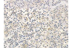 ABIN6261574 and ABIN6266963 at 1/100 staining human pituitary adenoma by IHC-P. (Epsin 1 Antikörper)
