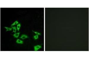 Immunofluorescence analysis of A549 cells, using FZD8 Antibody. (FZD8 Antikörper  (AA 31-80))