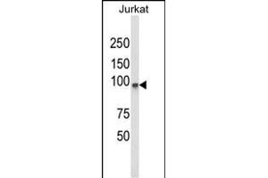 Western blot analysis of PLCL1 Antibody (N-term) (ABIN652796 and ABIN2842522) in Jurkat cell line lysates (35 μg/lane). (PLCL1 Antikörper  (N-Term))