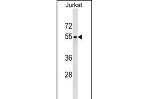 SEPT6 Antibody (C-term) (ABIN1537277 and ABIN2850133) western blot analysis in Jurkat cell line lysates (35 μg/lane).