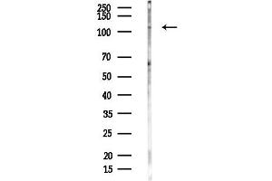 anti-Inter-alpha Globulin Inhibitor H2 Polypeptide (ITIH2) (C-Term) antibody