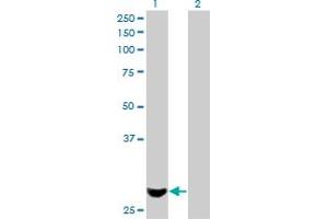 Western Blot analysis of PMM2 expression in transfected 293T cell line by PMM2 monoclonal antibody (M01), clone 2E9. (PMM2 Antikörper  (AA 47-111))