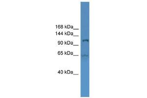 WB Suggested Anti-UBA6 Antibody Titration: 0. (UBA6 Antikörper  (Middle Region))