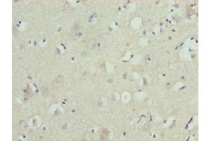 Immunohistochemistry of paraffin-embedded human brain tissue using ABIN7176547 at dilution of 1:100 (ZNF821 Antikörper  (AA 1-370))