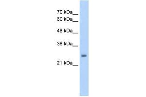 Western Blotting (WB) image for anti-NMDA Receptor Synaptonuclear Signaling and Neuronal Migration Factor (NSMF) (Middle Region) antibody (ABIN629701)