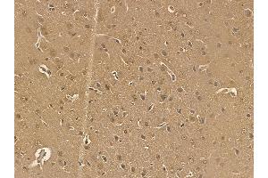 PUF60 Mouse Monoclonal Antibody at 1/100 staining rat brain tissue by IHC-P. (PUF60 Antikörper)