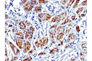 Formalin-fixed, paraffin-embedded human Uterus stained with Caldesmon Rabbit Recombinant Monoclonal Antibody (CALD1/1424R). (Rekombinanter Caldesmon Antikörper)