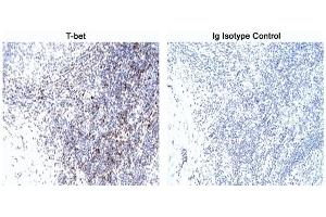 Immunohistochemistry (IHC) image for anti-T-Bet antibody (ABIN967673) (T-Bet Antikörper)