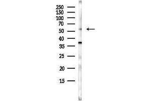 anti-GDP Dissociation Inhibitor 1 (GDI1) (Internal Region) antibody