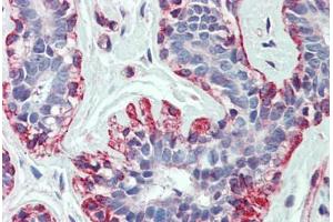 Human Breast: Formalin-Fixed, Paraffin-Embedded (FFPE)