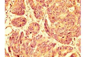 Immunohistochemistry (IHC) image for anti-G Protein-Coupled Receptor 32 (GPR32) (AA 1-44) antibody (ABIN7164493)