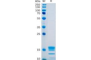 Human GITR Ligand Protein, His Tag on SDS-PAGE under reducing condition.