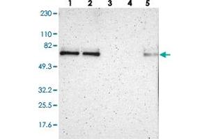 Western blot analysis of Lane 1: RT-4, Lane 2: U-251 MG, Lane 3: Human Plasma, Lane 4: Liver, Lane 5: Tonsil with ZNF384 polyclonal antibody  at 1:250-1:500 dilution. (ZNF384 Antikörper)