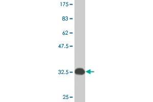 Western Blot detection against Immunogen (33. (ATOX1 Antikörper  (AA 1-68))