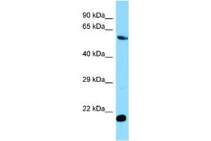 WB Suggested Anti-MOB1B Antibody Titration: 1. (MOBKL1A Antikörper  (C-Term))