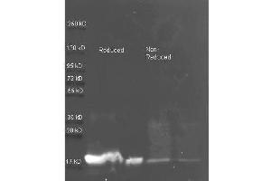 Western Blotting (WB) image for anti-Trypsin Inhibitor antibody (ABIN107871) (Trypsin Inhibitor Antikörper)