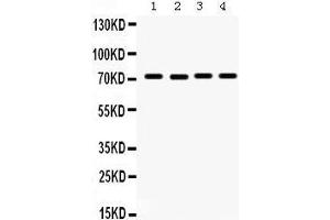 Western Blotting (WB) image for anti-Fragile X Mental Retardation 1 (FMR1) (AA 164-200), (N-Term) antibody (ABIN3042398) (FMR1 Antikörper  (N-Term))