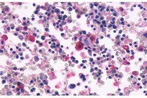Anti-CD97 antibody  ABIN1048416 IHC staining of human bone marrow. (CD97 Antikörper  (N-Term))