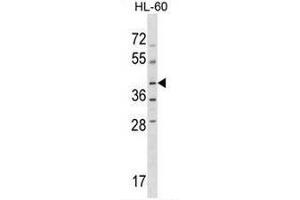 Western Blotting (WB) image for anti-Nitrogen Permease Regulator-Like 2 (S. Cerevisiae) (NPRL2) (AA 345-373), (C-Term) antibody (ABIN955400)