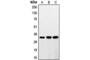 Western blot analysis of RNF144A expression in HeLa (A), HepG2 (B), Jurkat (C) whole cell lysates. (RNF144A Antikörper  (Center))