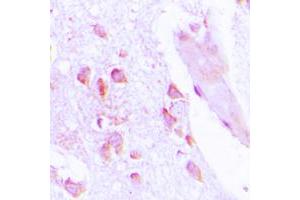 Immunohistochemical analysis of ABHD12B staining in human brain formalin fixed paraffin embedded tissue section.