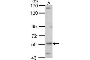 WB Image Sample (30 ug of whole cell lysate) A: A431 , 7. (ADCK4 Antikörper  (Center))