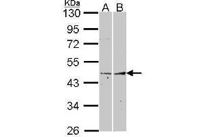 WB Image Sample (30 ug of whole cell lysate) A: A431 , B: Hela 10% SDS PAGE Fibromodulin antibody antibody diluted at 1:1000 (Fibromodulin Antikörper)